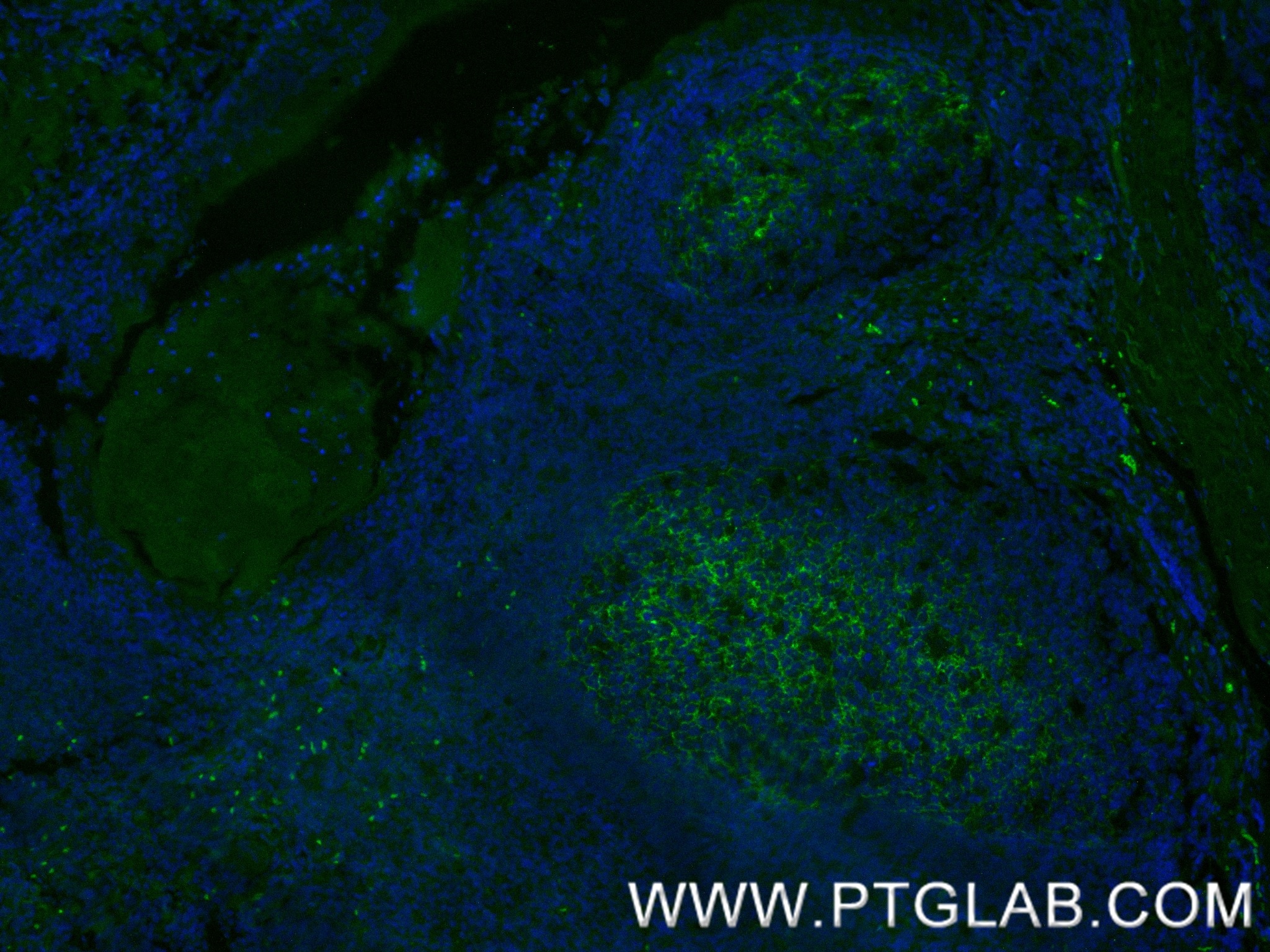 Immunofluorescence (IF) / fluorescent staining of human tonsil tissue using CD21 Recombinant monoclonal antibody (87097-5-RR)