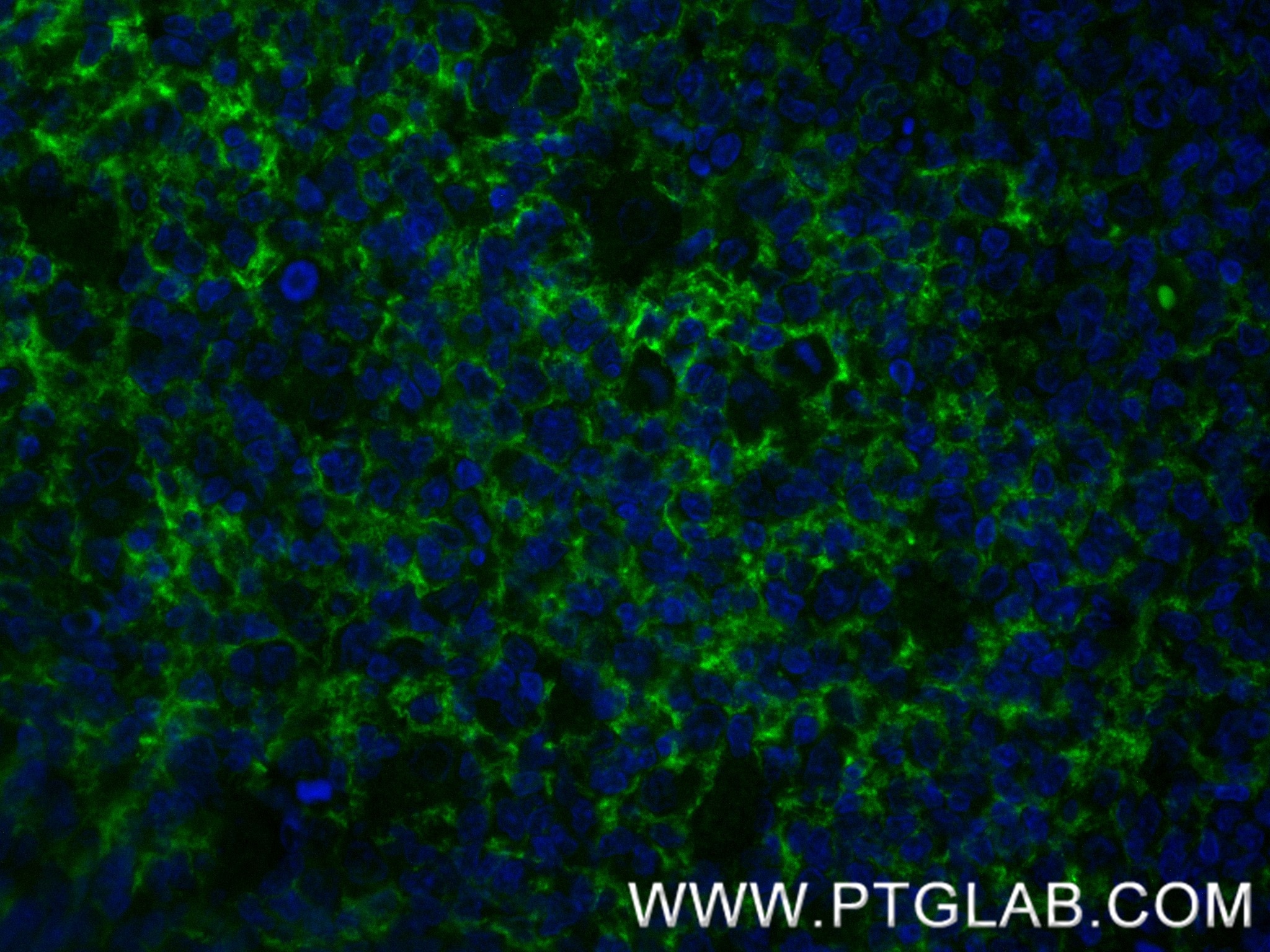 Immunofluorescence (IF) / fluorescent staining of human tonsil tissue using CD21 Recombinant monoclonal antibody (87097-5-RR)