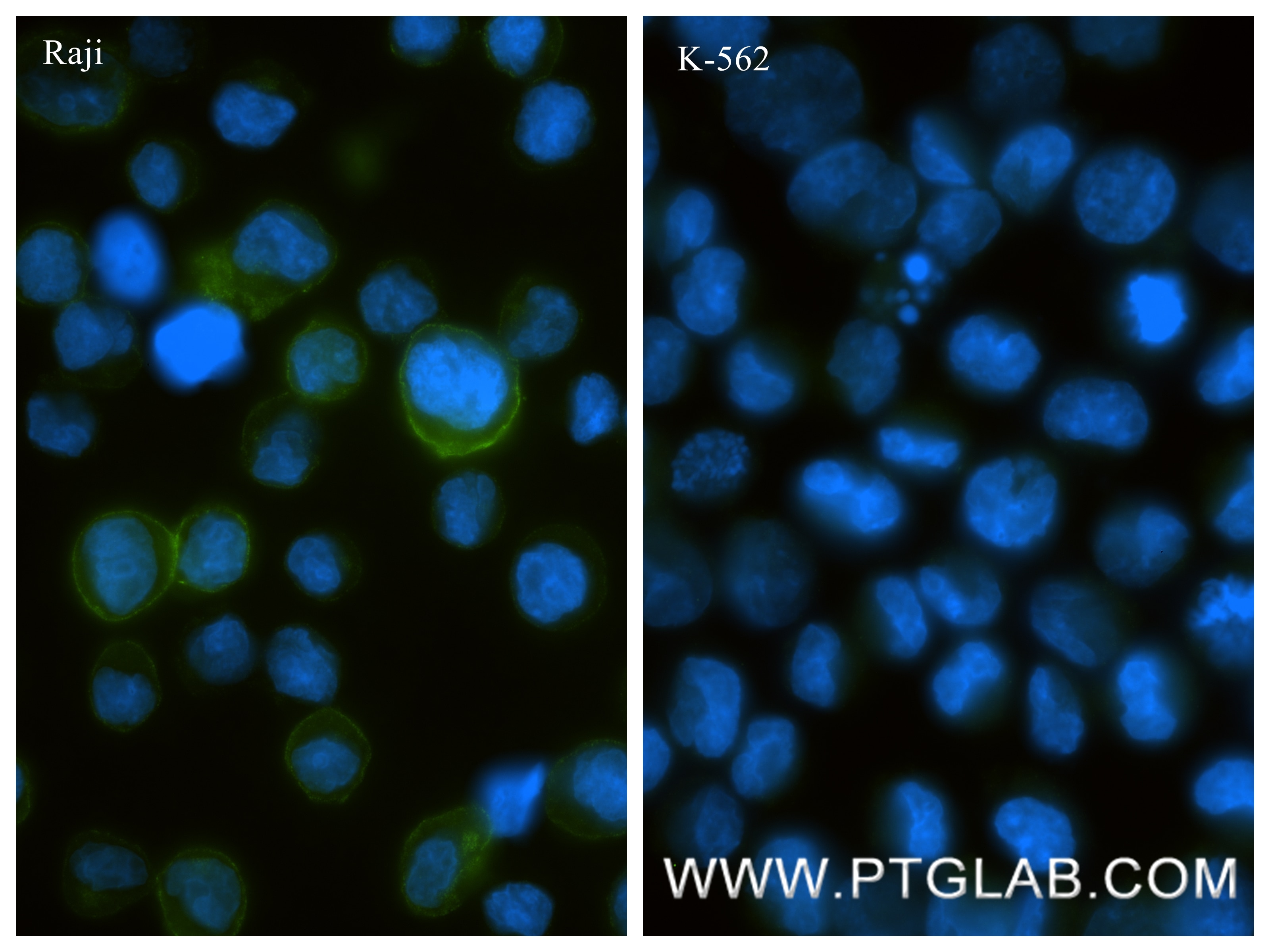 Immunofluorescence (IF) / fluorescent staining of Raji cells using CD21 Recombinant monoclonal antibody (87097-5-RR)