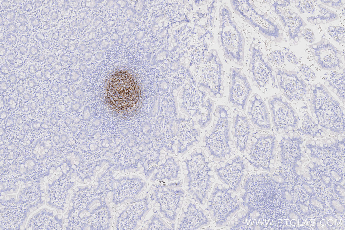 Immunohistochemistry (IHC) staining of human small intestine tissue using CD21 Recombinant monoclonal antibody (87097-5-RR)