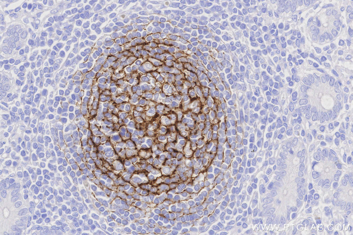 Immunohistochemistry (IHC) staining of human small intestine tissue using CD21 Recombinant monoclonal antibody (87097-5-RR)