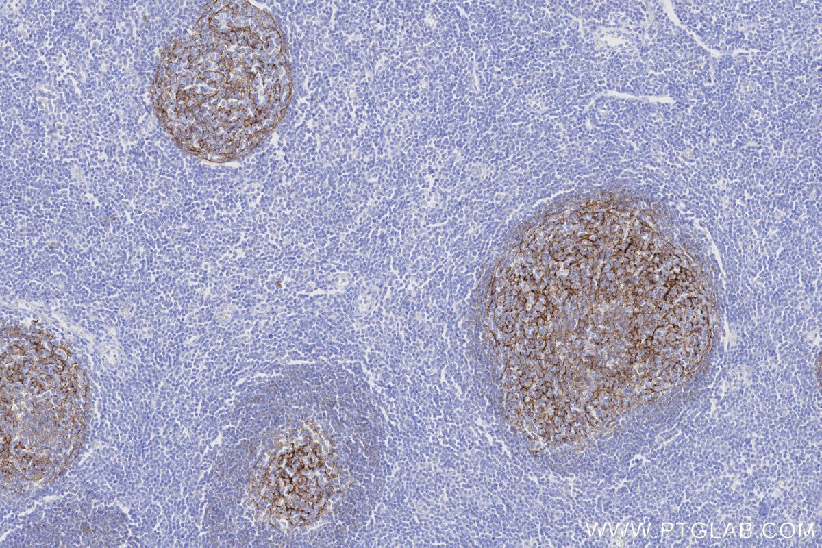 Immunohistochemistry (IHC) staining of human tonsillitis tissue using CD21 Recombinant monoclonal antibody (87097-5-RR)