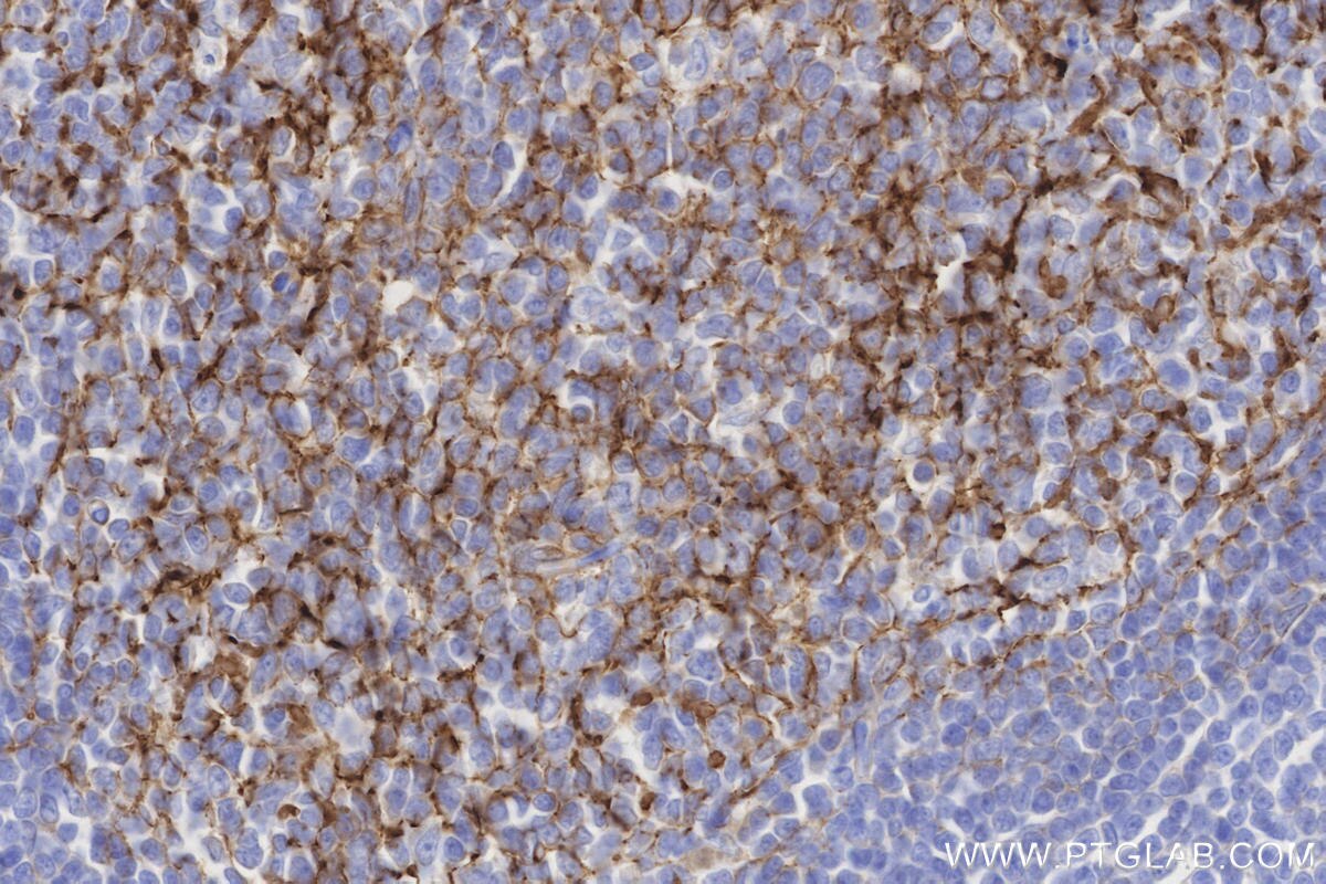 Immunohistochemistry (IHC) staining of human tonsillitis tissue using CD21 Recombinant monoclonal antibody (87097-5-RR)