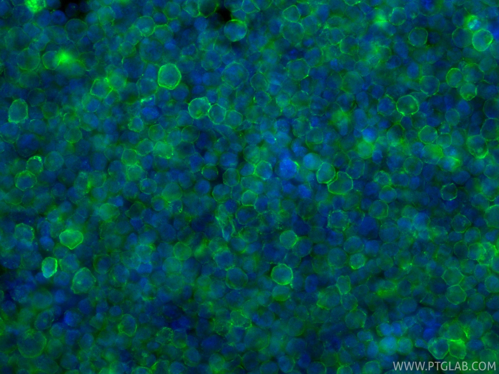 IF Staining of Raji using CL488-87097-5 Immunofluorescence (IF) / fluorescent staining of Raji cells using CoraLite® Plus 488-conjugated CD21 Recombinant mon (CL488-87097-5)