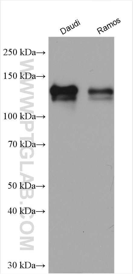 Western Blot (WB) analysis of various lysates using CD22 Polyclonal antibody (21894-1-AP)