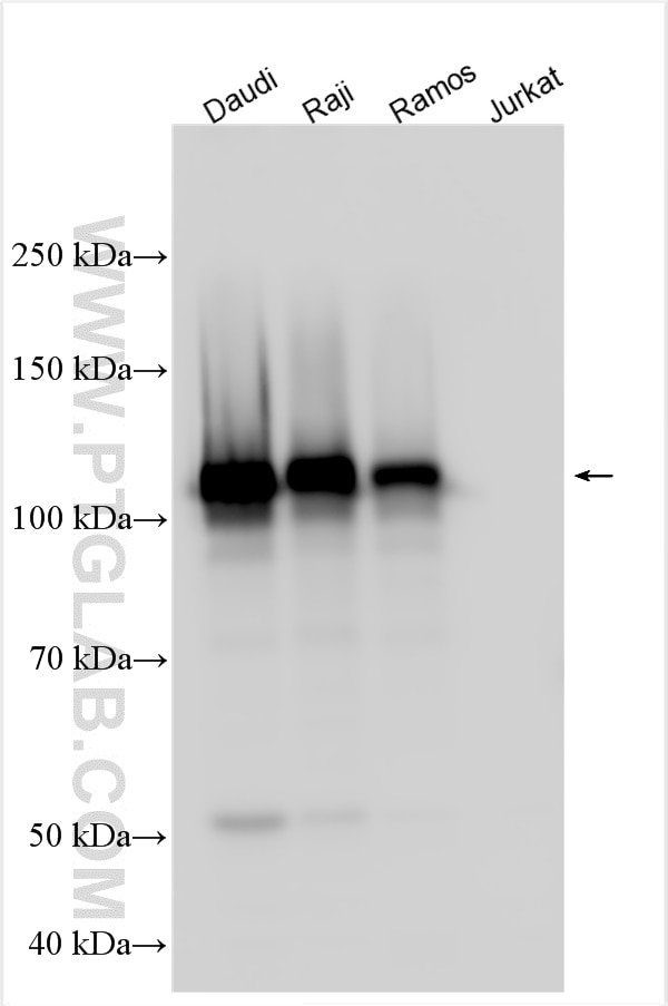 Western Blot (WB) analysis of various lysates using CD22 Polyclonal antibody (30954-1-AP)