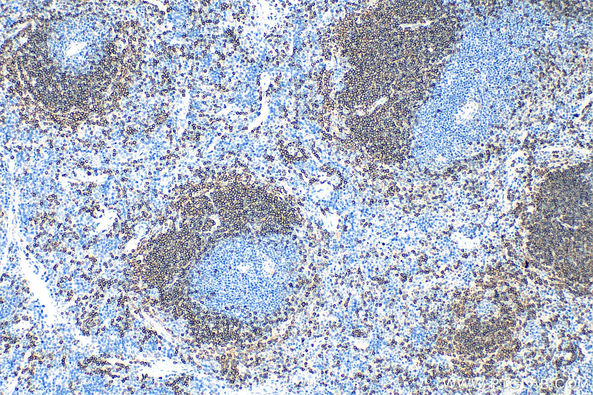 Immunohistochemistry (IHC) staining of mouse spleen tissue using CD22 Polyclonal antibody (32183-1-AP)