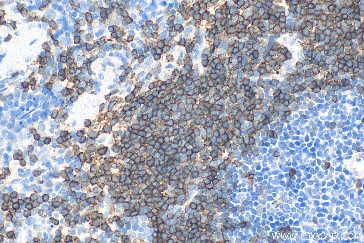 Immunohistochemistry (IHC) staining of mouse spleen tissue using CD22 Polyclonal antibody (32183-1-AP)