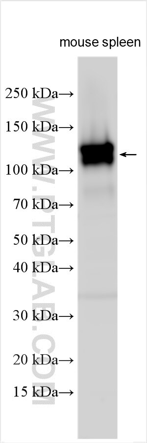 Western Blot (WB) analysis of various lysates using CD22 Polyclonal antibody (32183-1-AP)