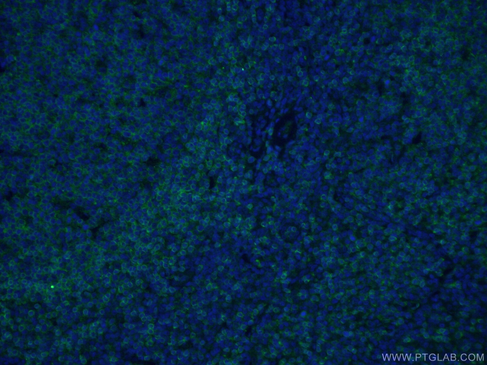 Immunofluorescence (IF) / fluorescent staining of human tonsillitis tissue using CD22 Monoclonal antibody (66103-1-Ig)