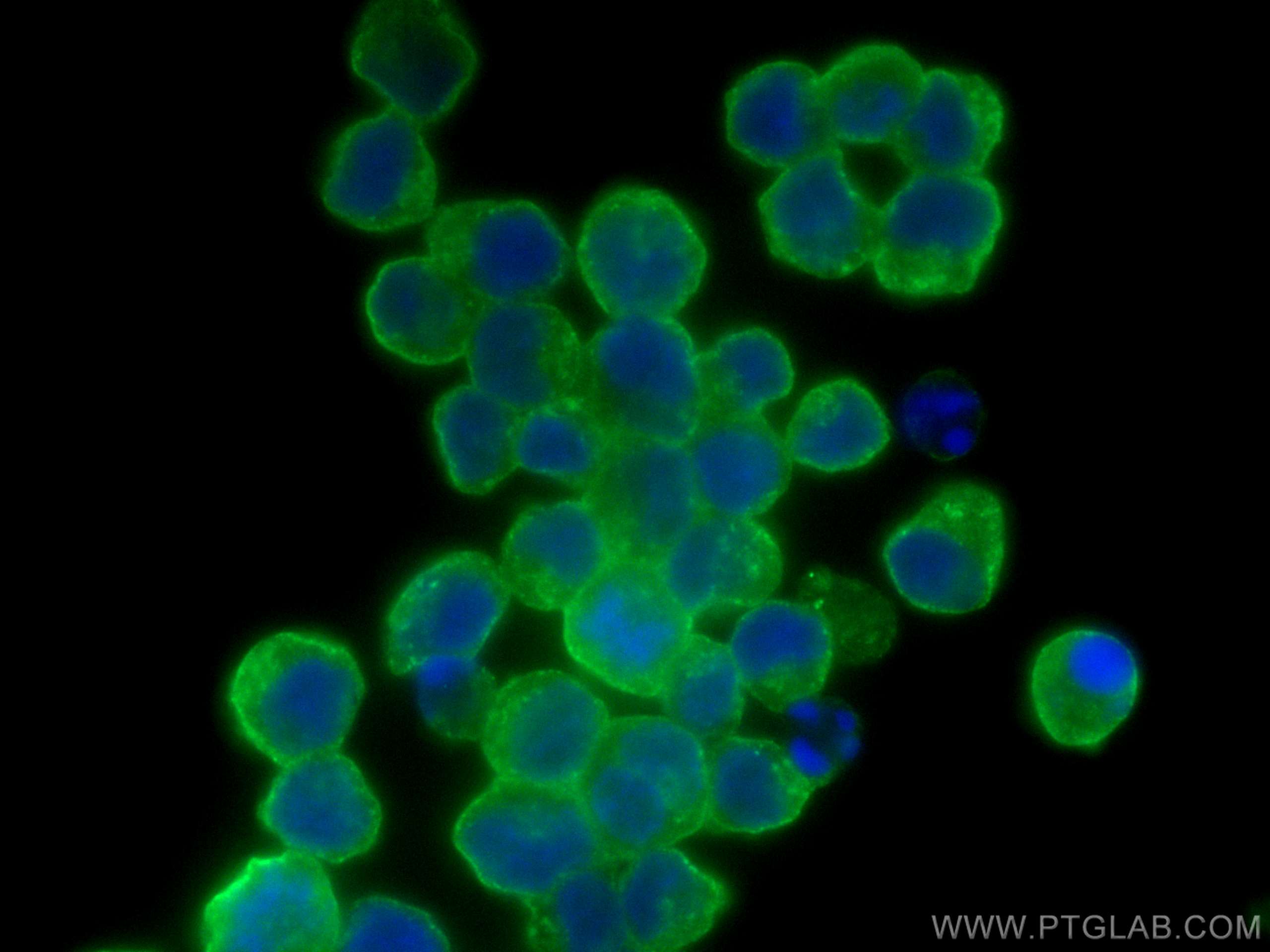 Immunofluorescence (IF) / fluorescent staining of Raji cells using CD22 Monoclonal antibody (66103-1-Ig)