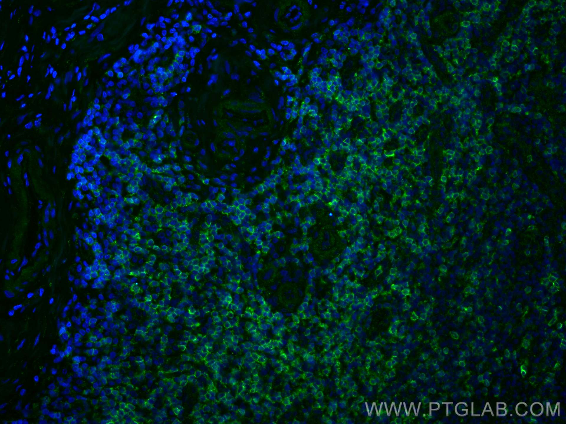 Immunofluorescence (IF) / fluorescent staining of human tonsillitis tissue using CD22 Monoclonal antibody (66103-1-Ig)