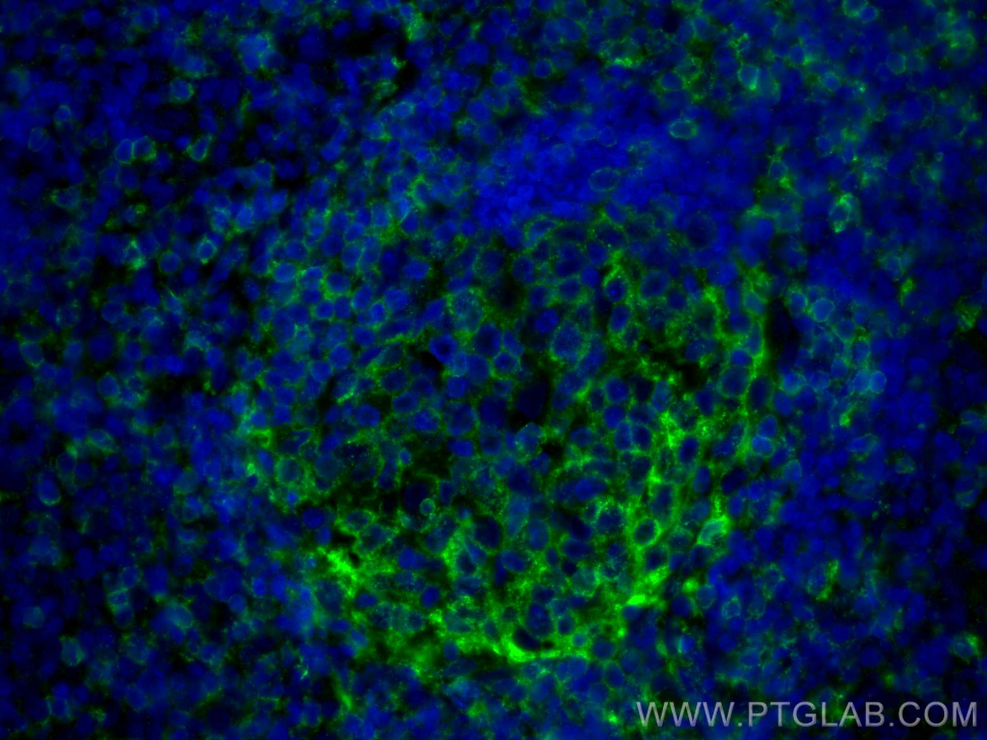 Immunofluorescence (IF) / fluorescent staining of human tonsillitis tissue using CD22 Monoclonal antibody (66103-1-Ig)