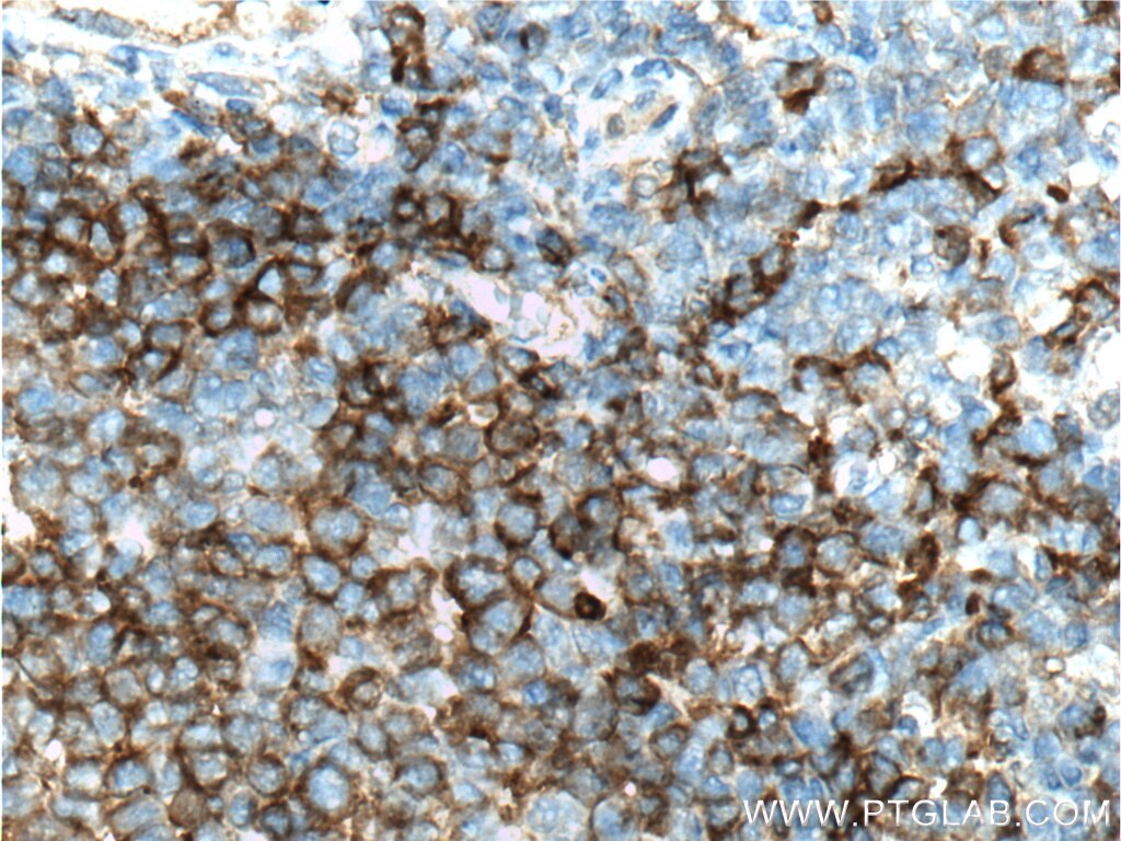 CD22 Monoclonal antibody