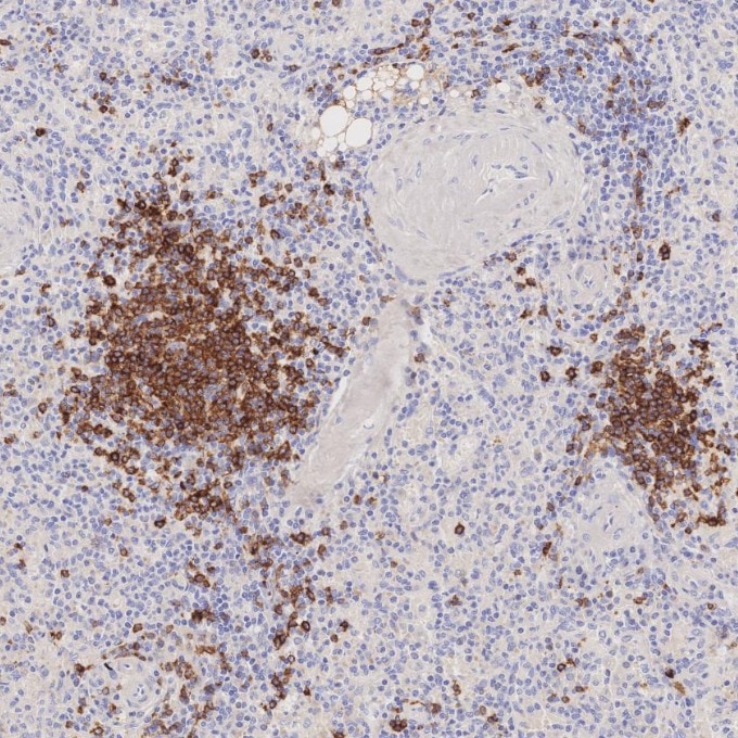 IHC staining of human spleen using 66103-1-Ig Immunohistochemistry (IHC) staining of human spleen tissue using CD22 Monoclonal antibody (66103-1-Ig)