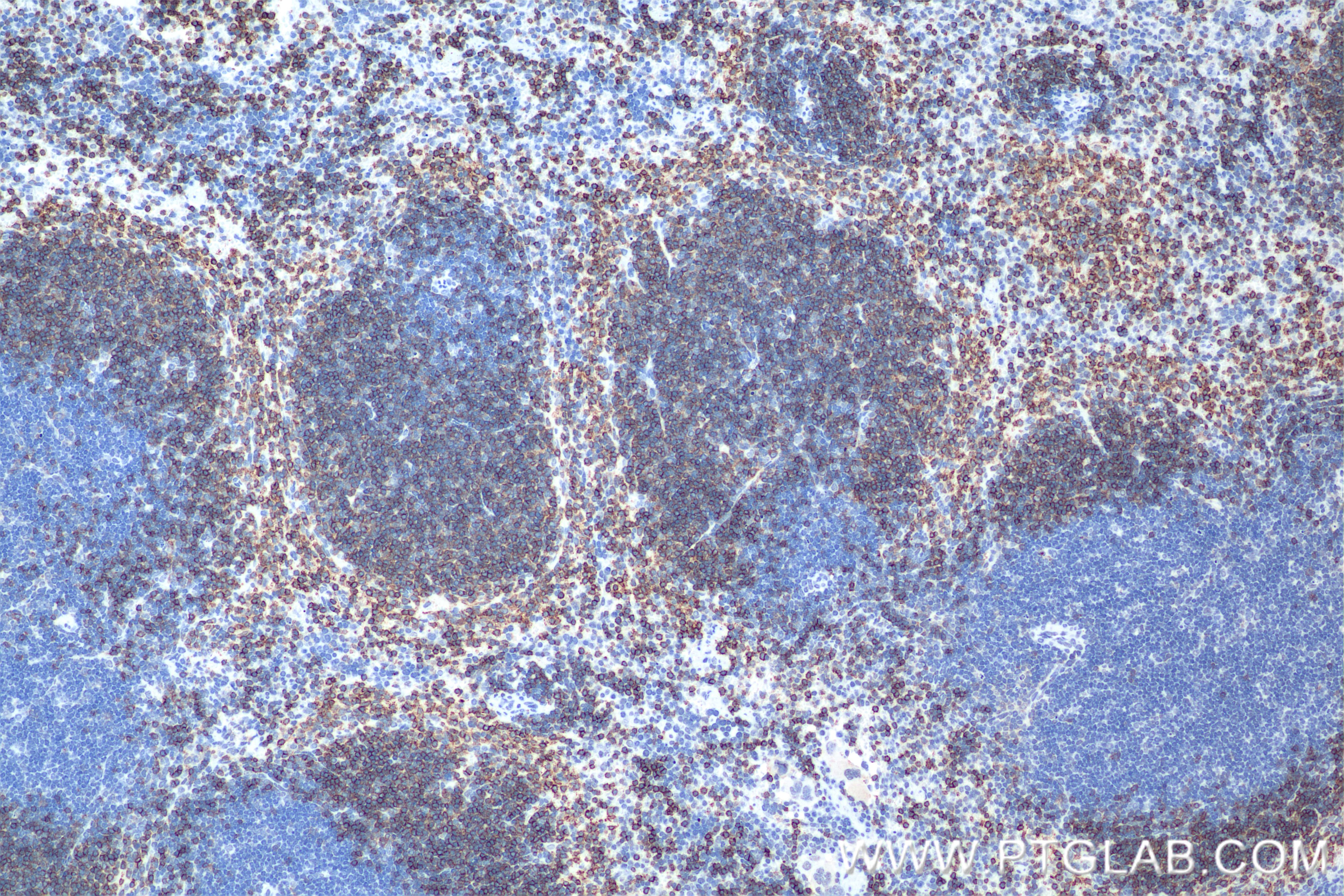 Immunohistochemistry (IHC) staining of mouse spleen tissue using CD22 Recombinant antibody (86128-1-RR)