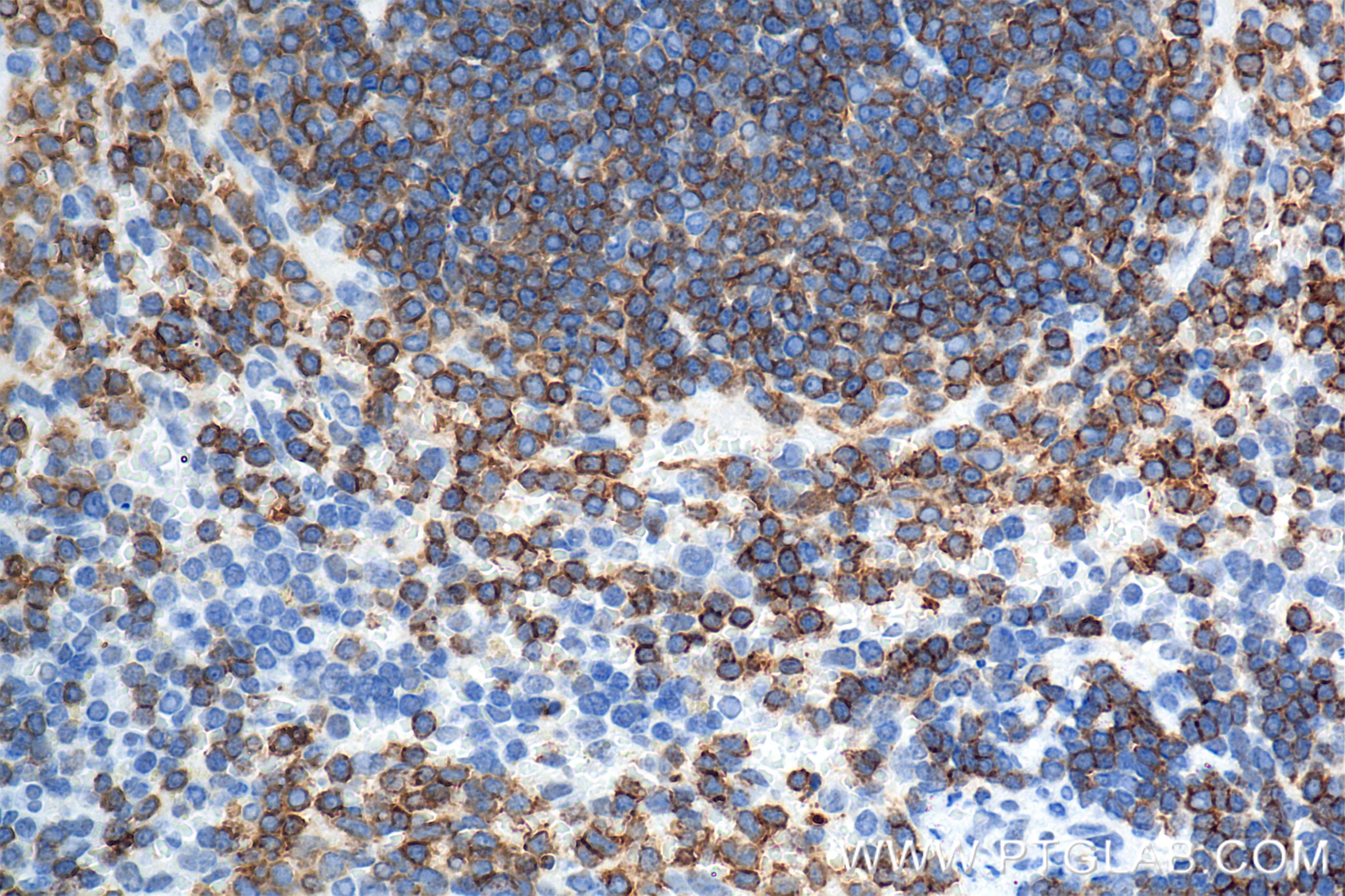 Immunohistochemistry (IHC) staining of mouse spleen tissue using CD22 Recombinant antibody (86128-1-RR)