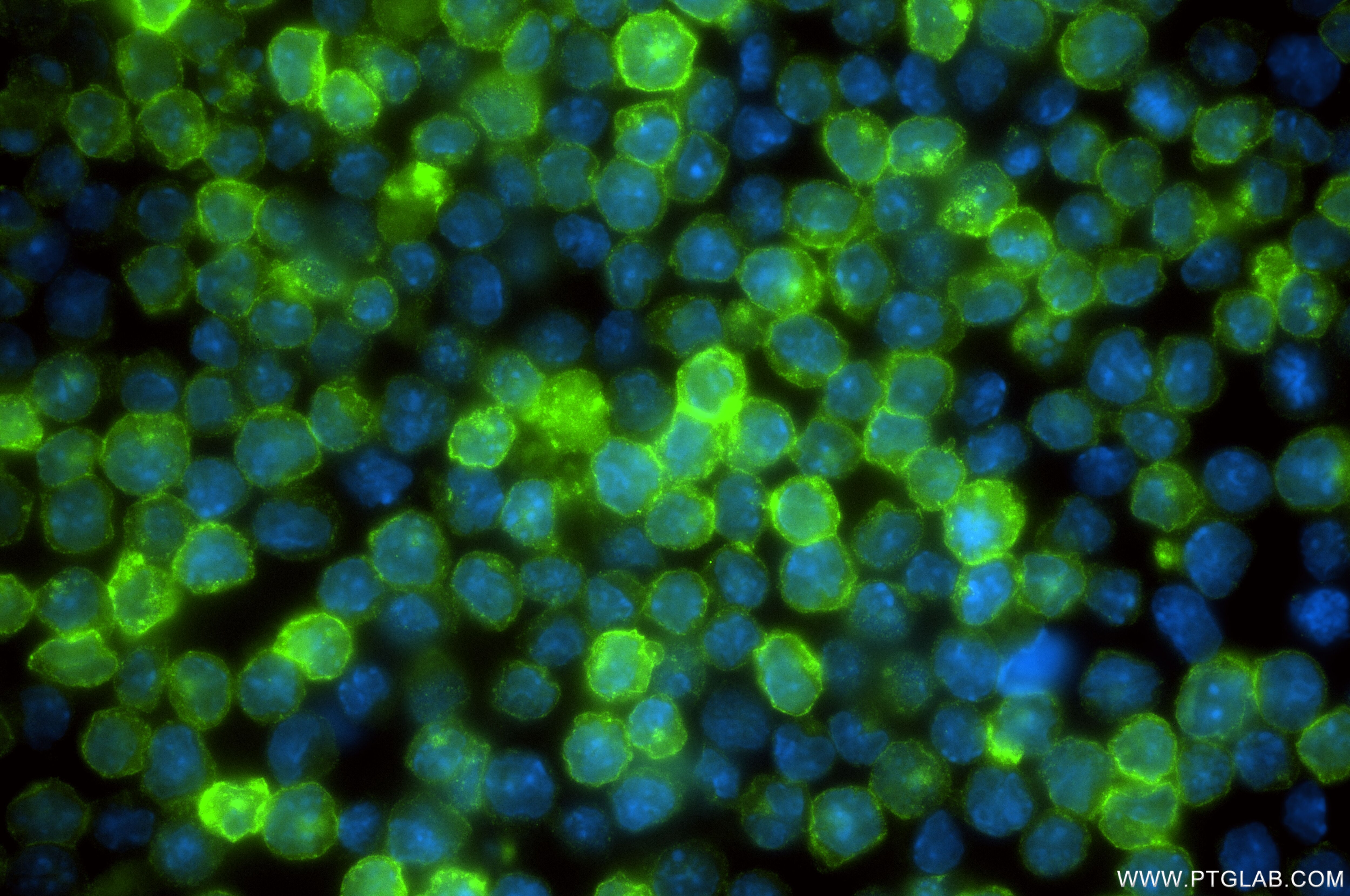 Immunofluorescence (IF) / fluorescent staining of A20 cells using CD22 Recombinant antibody (86128-2-RR)