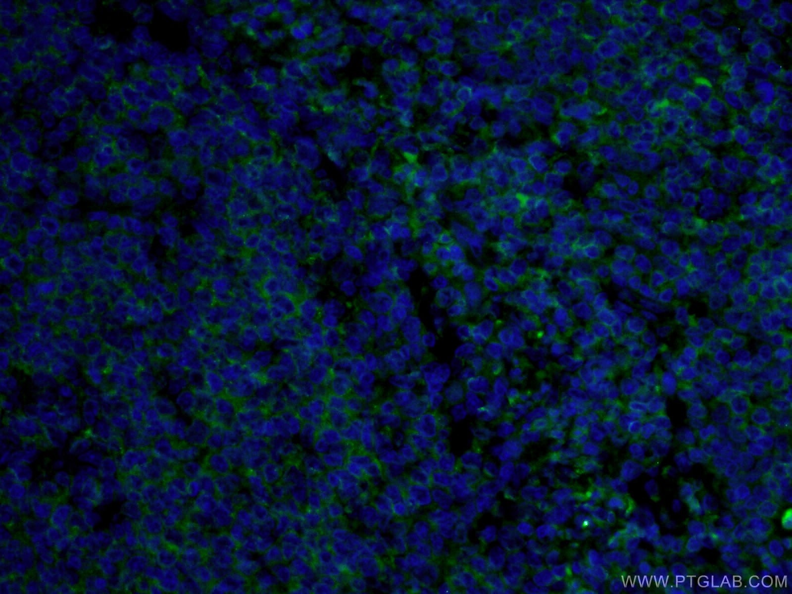 IF Staining of human tonsillitis using CL488-66103