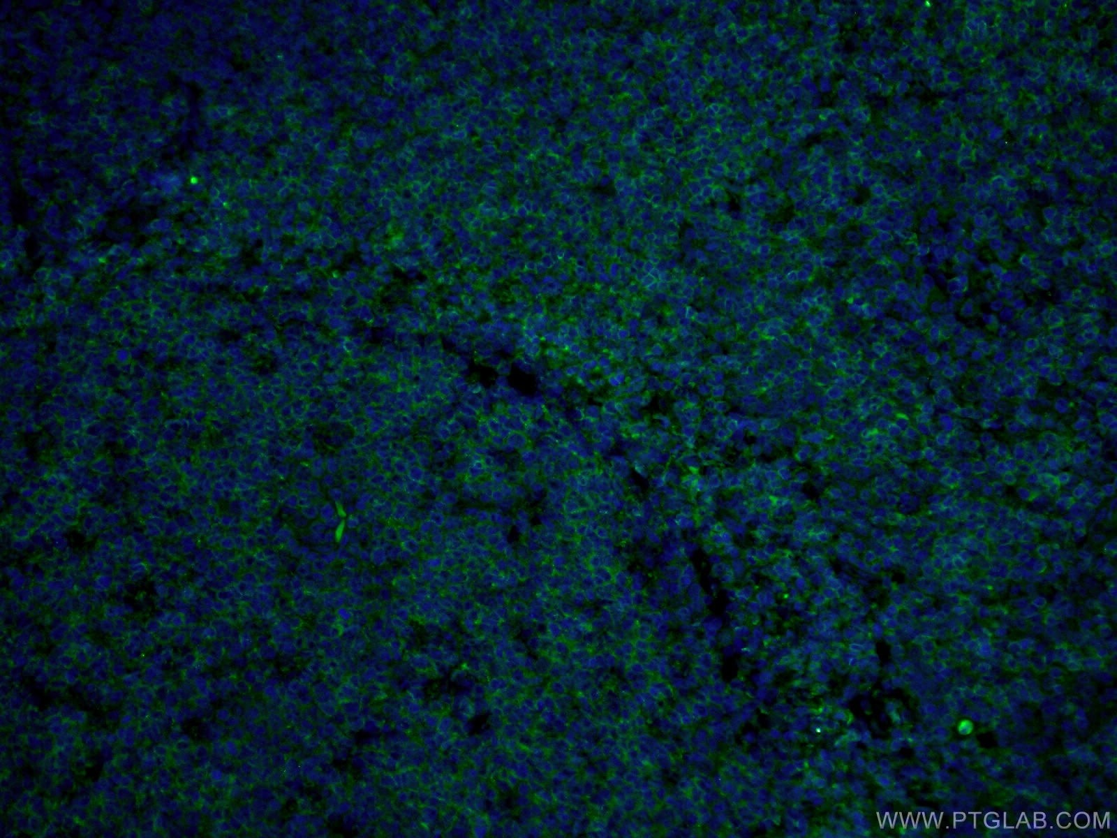 Immunofluorescence (IF) / fluorescent staining of human tonsillitis tissue using CoraLite®488-conjugated CD22 Monoclonal antibody (CL488-66103)