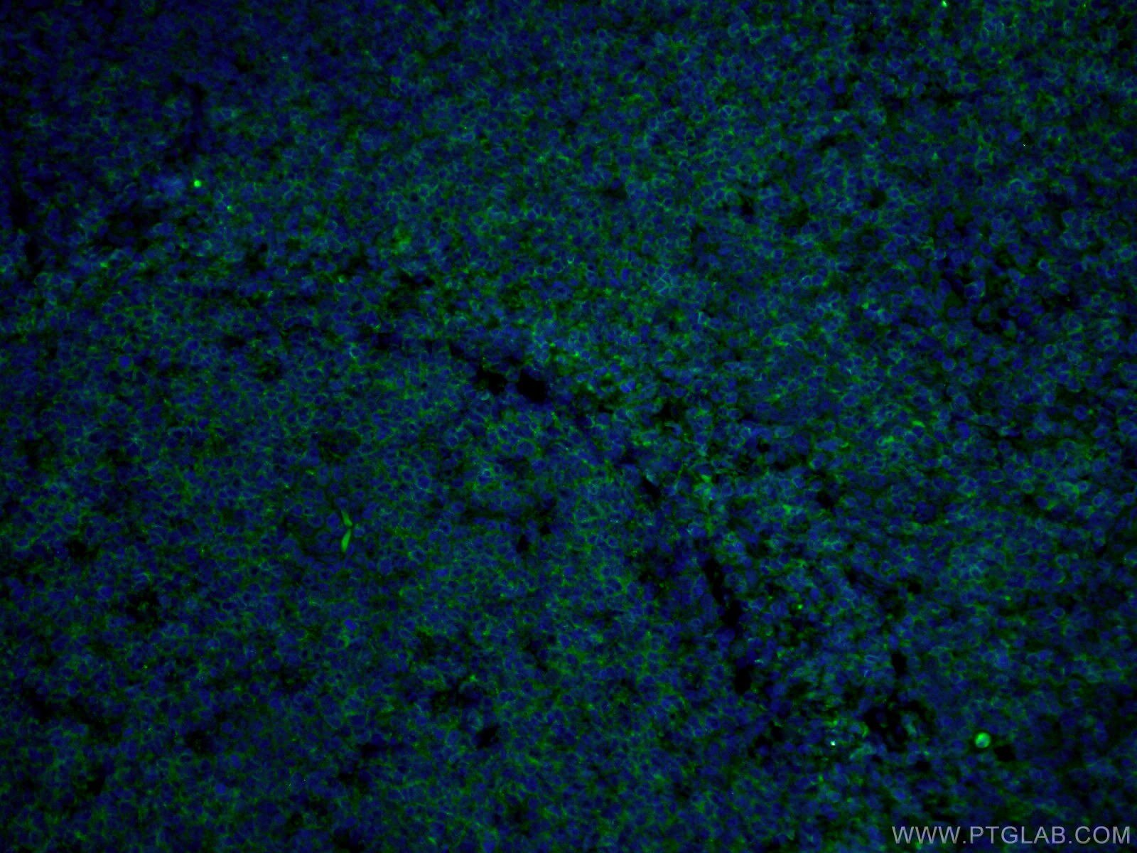 Immunofluorescence (IF) / fluorescent staining of human tonsillitis tissue using CoraLite®488-conjugated CD22 Monoclonal antibody (CL488-66103)