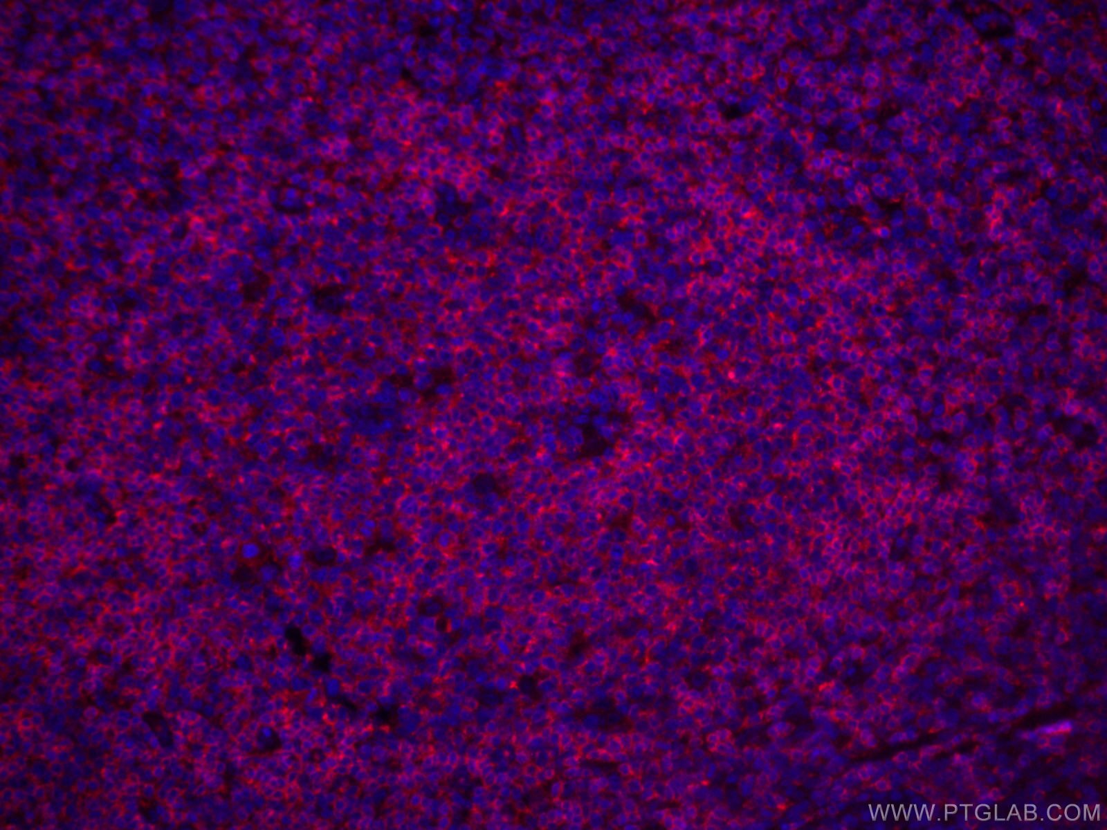 Immunofluorescence (IF) / fluorescent staining of human tonsillitis tissue using CoraLite®594-conjugated CD22 Monoclonal antibody (CL594-66103)