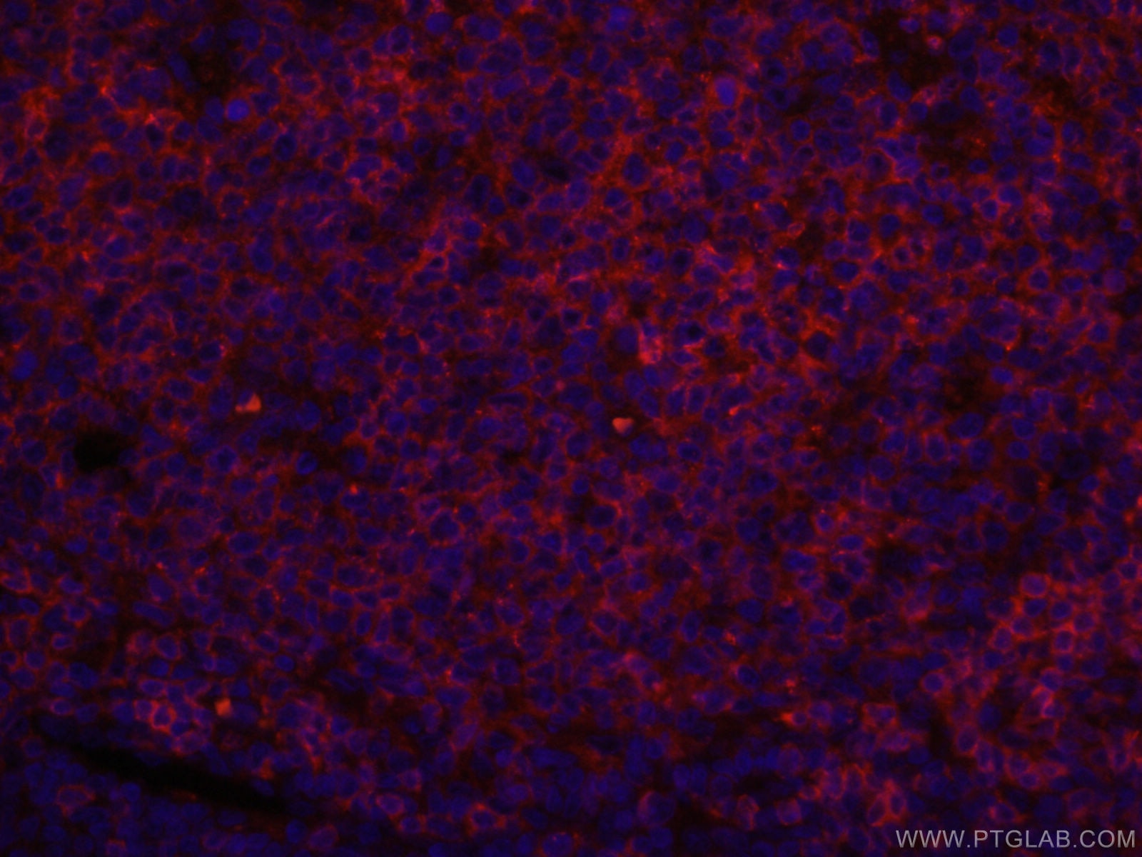 Immunofluorescence (IF) / fluorescent staining of human tonsillitis tissue using CoraLite®594-conjugated CD22 Monoclonal antibody (CL594-66103)