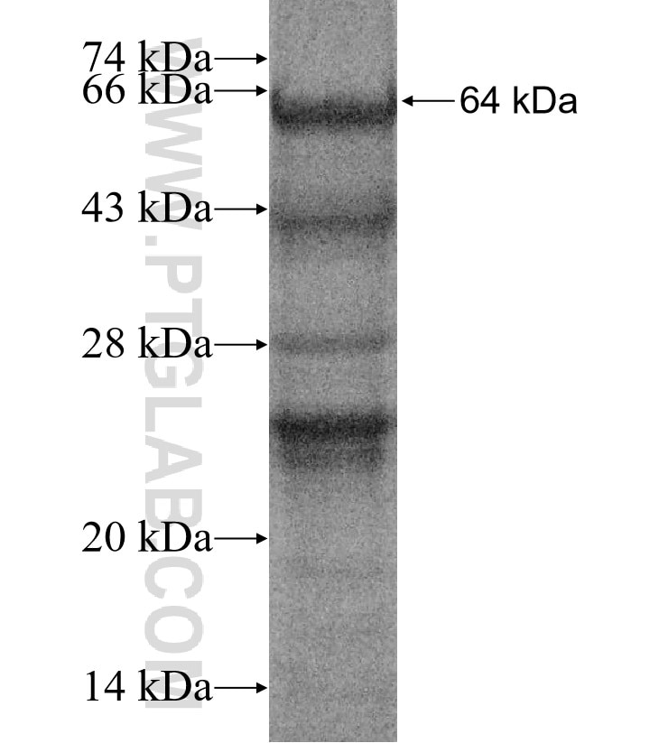 CD22 fusion protein Ag16607 SDS-PAGE