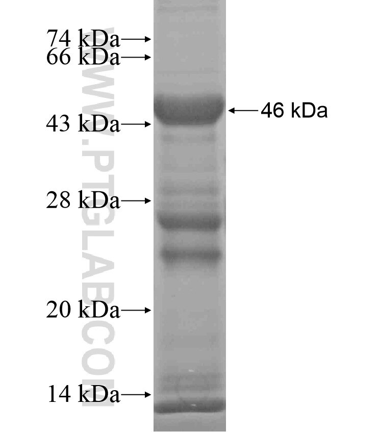 CD22 fusion protein Ag17986 SDS-PAGE