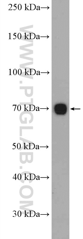 Western Blot (WB) analysis of Jurkat cells using CD226 Polyclonal antibody (17842-1-AP)