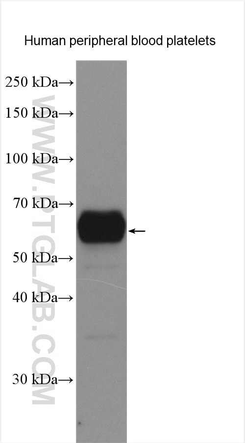 Western Blot (WB) analysis of various lysates using CD226 Polyclonal antibody (17842-1-AP)