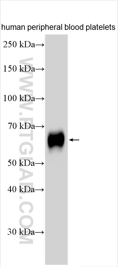Western Blot (WB) analysis of human peripheral blood platelets using CD226 Polyclonal antibody (30727-1-AP)