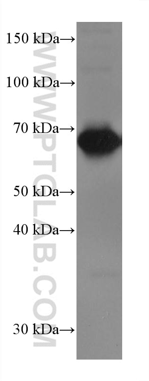 Western Blot (WB) analysis of human peripheral blood platelets using CD226 Monoclonal antibody (67653-1-Ig)