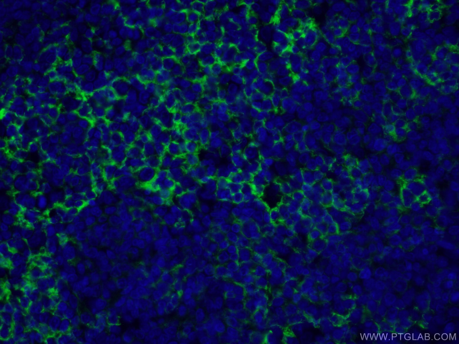 Immunofluorescence (IF) / fluorescent staining of human tonsillitis tissue using CD23 Monoclonal antibody (60208-1-Ig)