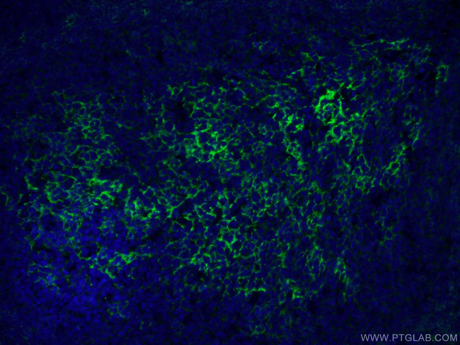 Immunofluorescence (IF) / fluorescent staining of human tonsillitis tissue using CD23 Monoclonal antibody (60208-1-Ig)