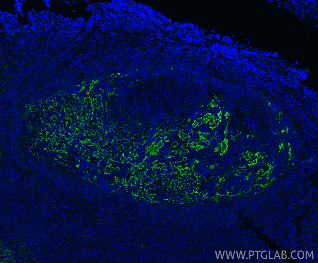 Immunofluorescence (IF) / fluorescent staining of human tonsillitis tissue using CD23 Monoclonal antibody (60208-1-Ig)