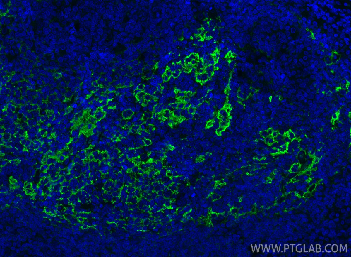 Immunofluorescence (IF) / fluorescent staining of human tonsillitis tissue using CD23 Monoclonal antibody (60208-1-Ig)
