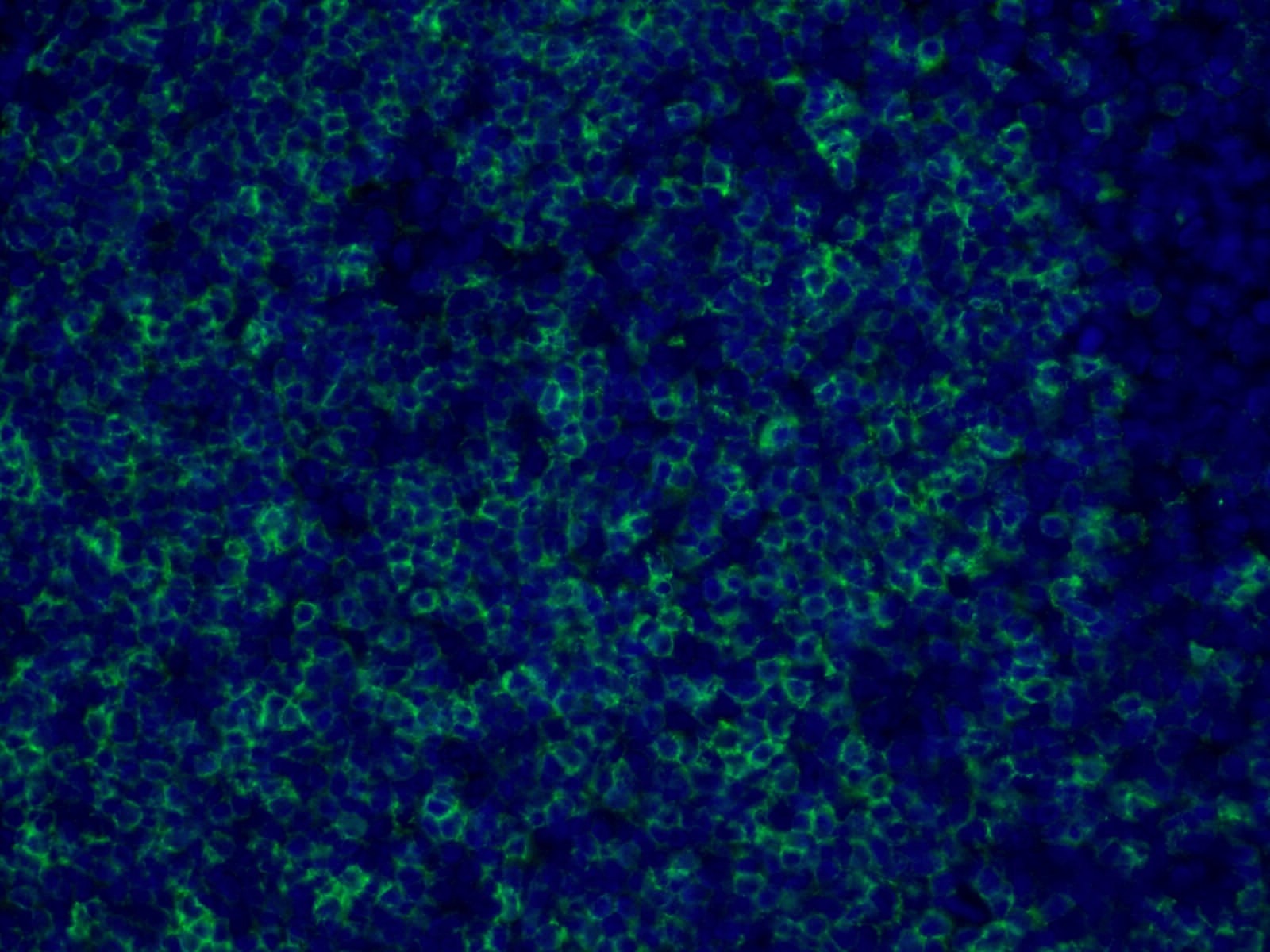 Immunofluorescence (IF) / fluorescent staining of human tonsillitis tissue using CD23 Monoclonal antibody (60208-2-Ig)