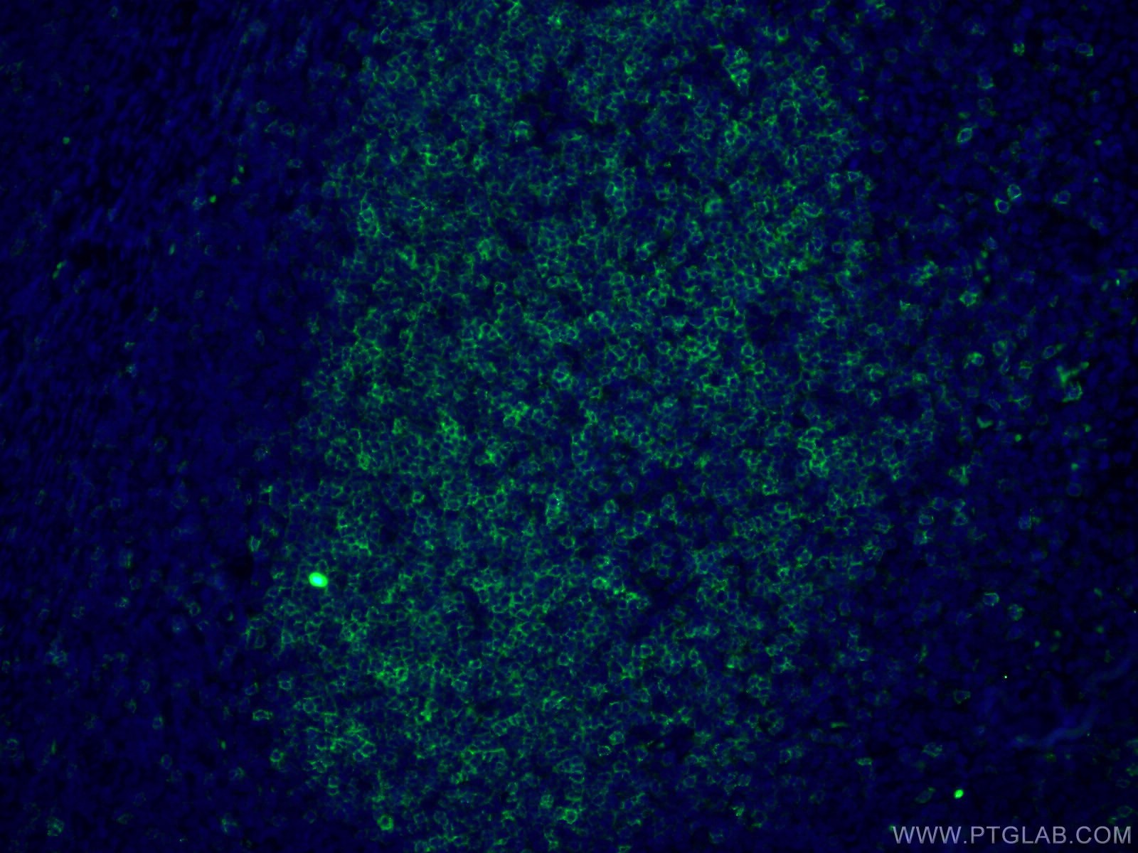 Immunofluorescence (IF) / fluorescent staining of human tonsillitis tissue using CD23 Monoclonal antibody (60208-2-Ig)