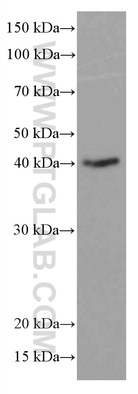Western Blot (WB) analysis of Raji cells using CD23 Monoclonal antibody (60208-2-Ig)