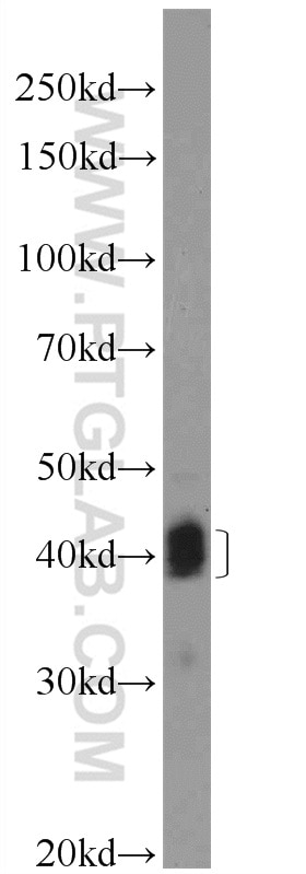 Western Blot (WB) analysis of Raji cells using CD23 Polyclonal antibody (18642-1-AP)
