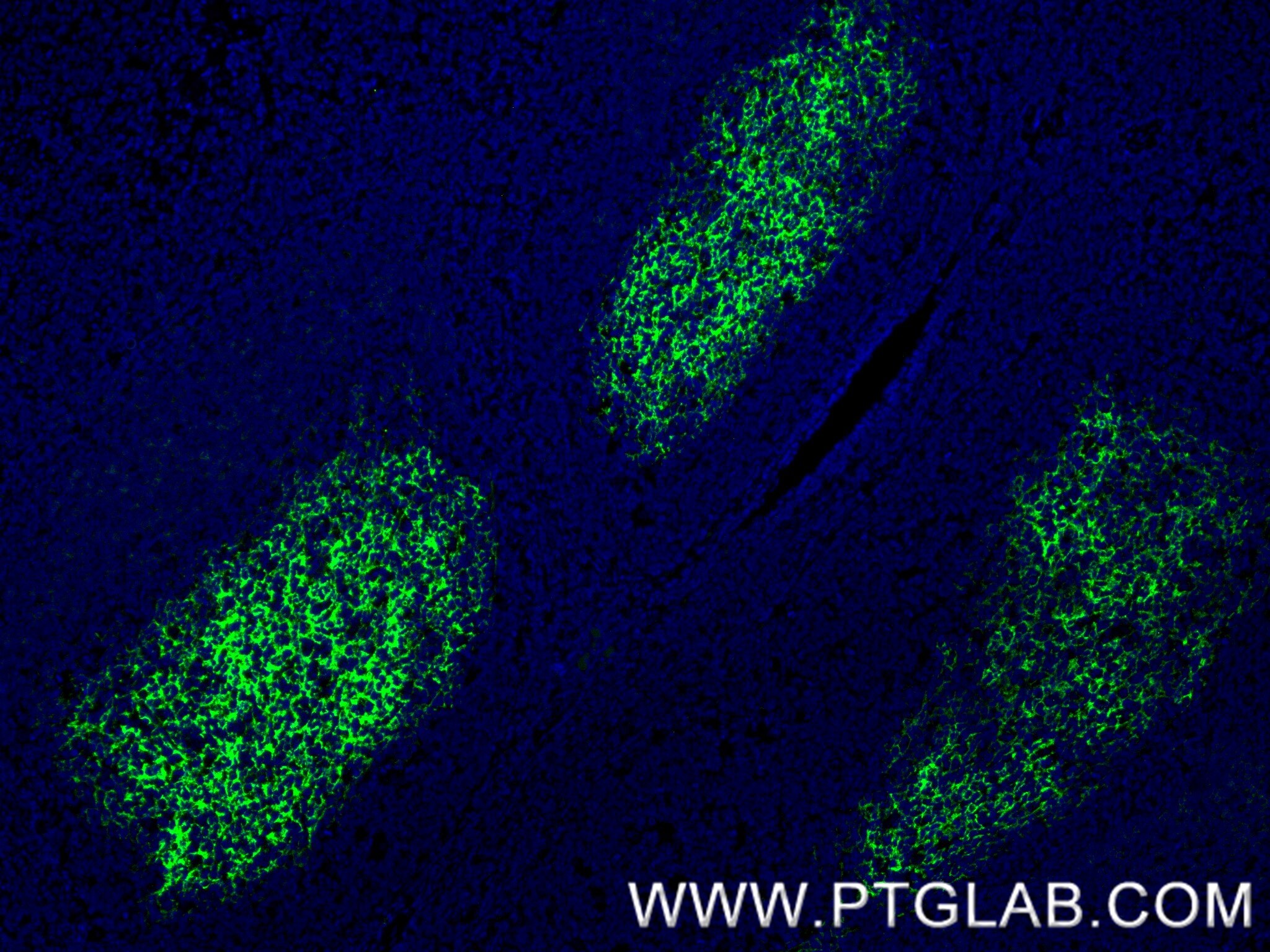 Immunofluorescence (IF) / fluorescent staining of human tonsil tissue using CD23 Recombinant monoclonal antibody (84024-2-RR)