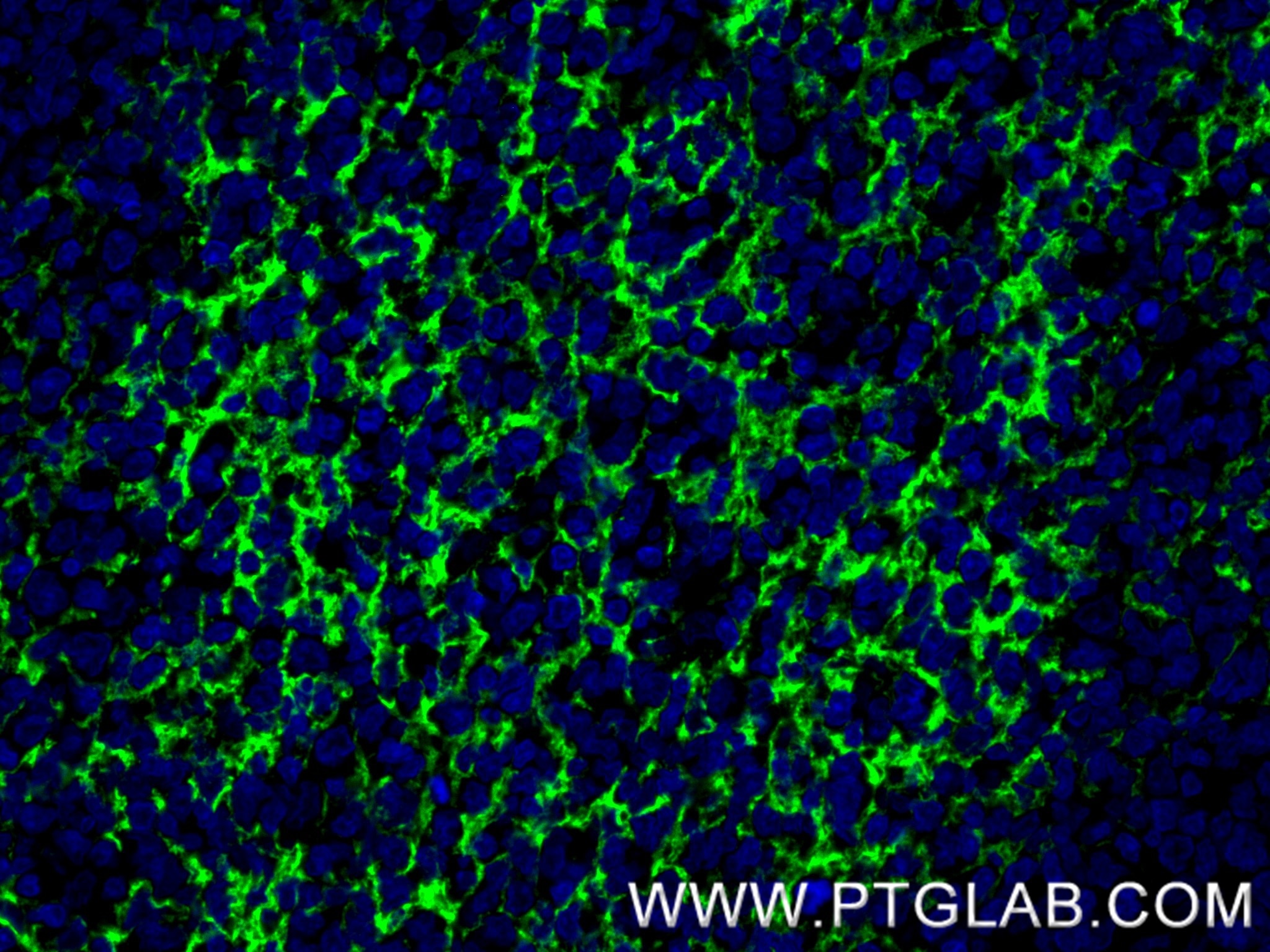Immunofluorescence (IF) / fluorescent staining of human tonsil tissue using CD23 Recombinant monoclonal antibody (84024-2-RR)
