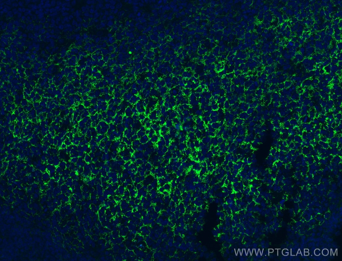 Immunofluorescence (IF) / fluorescent staining of human tonsillitis tissue using CoraLite®488-conjugated CD23 Monoclonal antibody (CL488-60208-2)