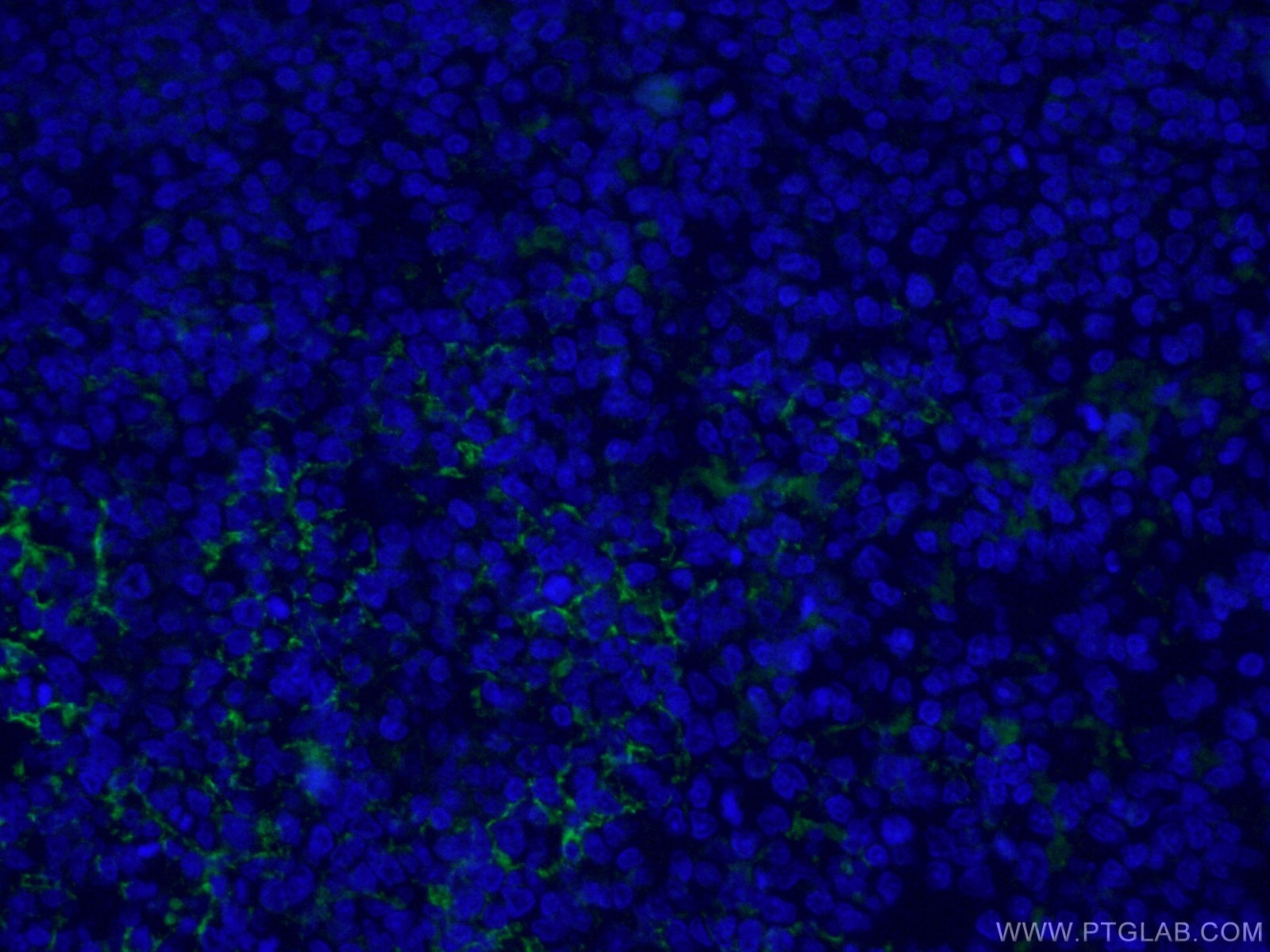 Immunofluorescence (IF) / fluorescent staining of human tonsillitis tissue using CoraLite® Plus 488-conjugated CD23 Monoclonal anti (CL488-60208)
