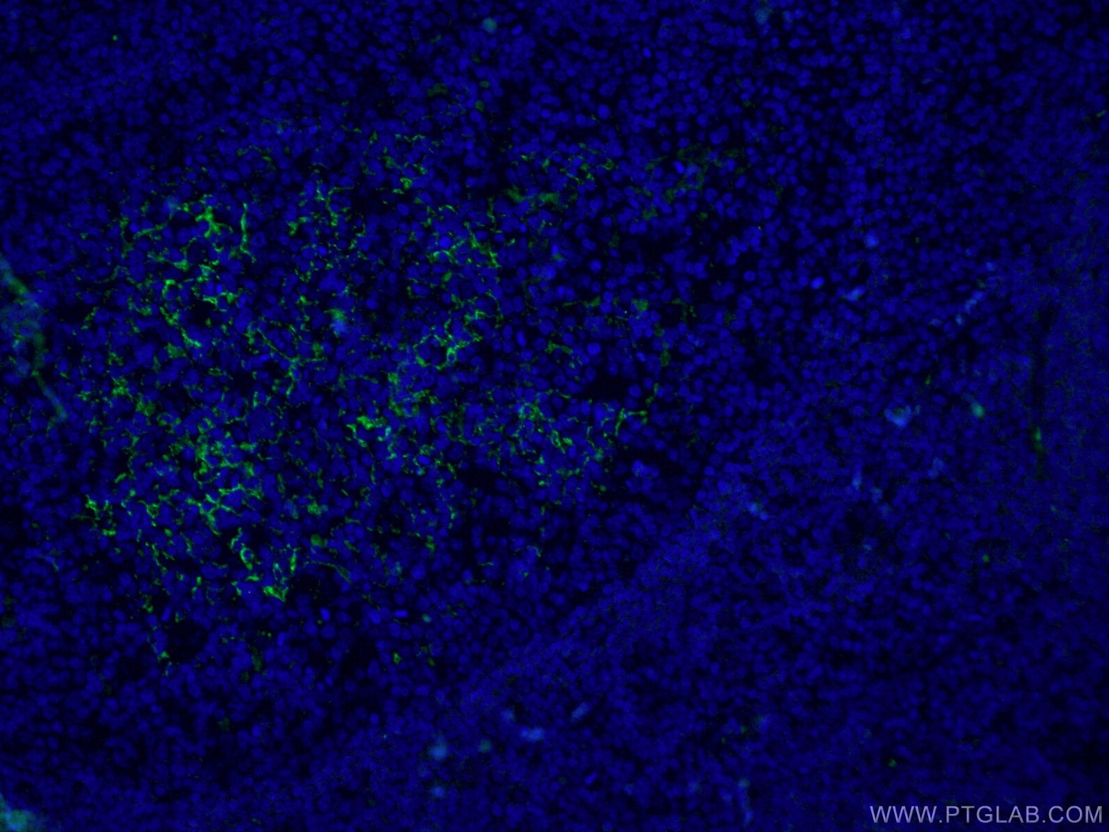 Immunofluorescence (IF) / fluorescent staining of human tonsillitis tissue using CoraLite® Plus 488-conjugated CD23 Monoclonal anti (CL488-60208)