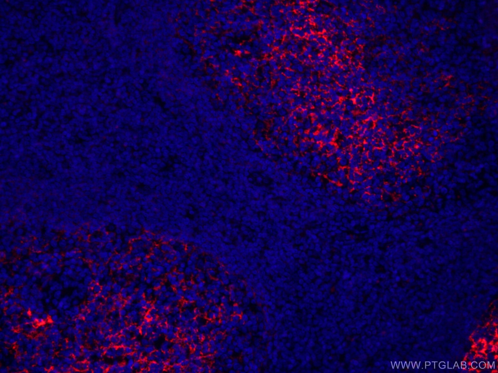 Immunofluorescence (IF) / fluorescent staining of human tonsillitis tissue using CoraLite®594-conjugated CD23 Monoclonal antibody (CL594-60208)