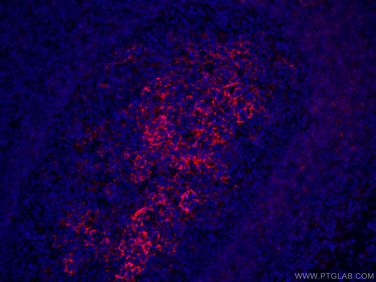Immunofluorescence (IF) / fluorescent staining of human tonsillitis tissue using CoraLite®594-conjugated CD23 Monoclonal antibody (CL594-60208)