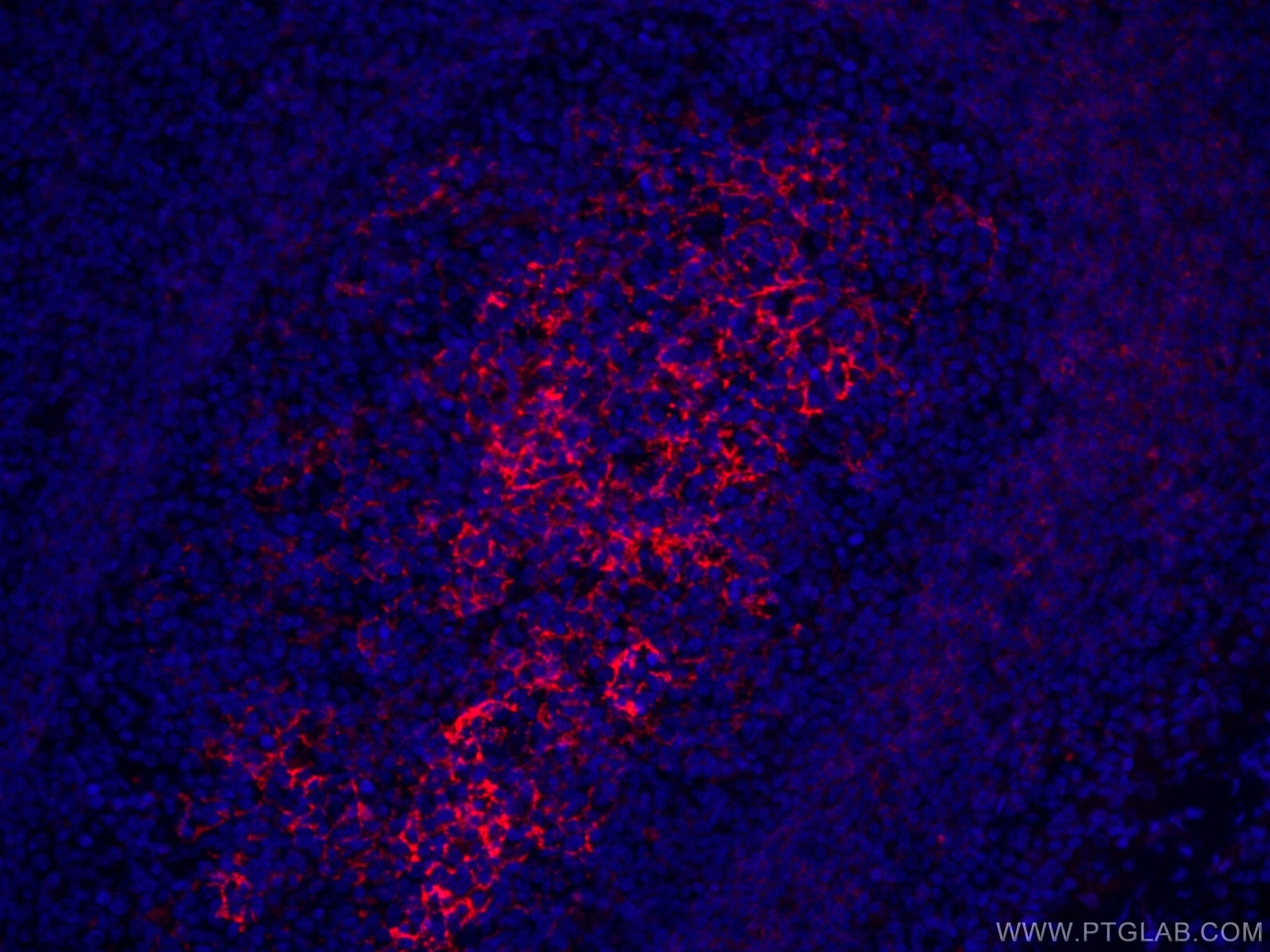 IF Staining of human tonsillitis using CL594-60208