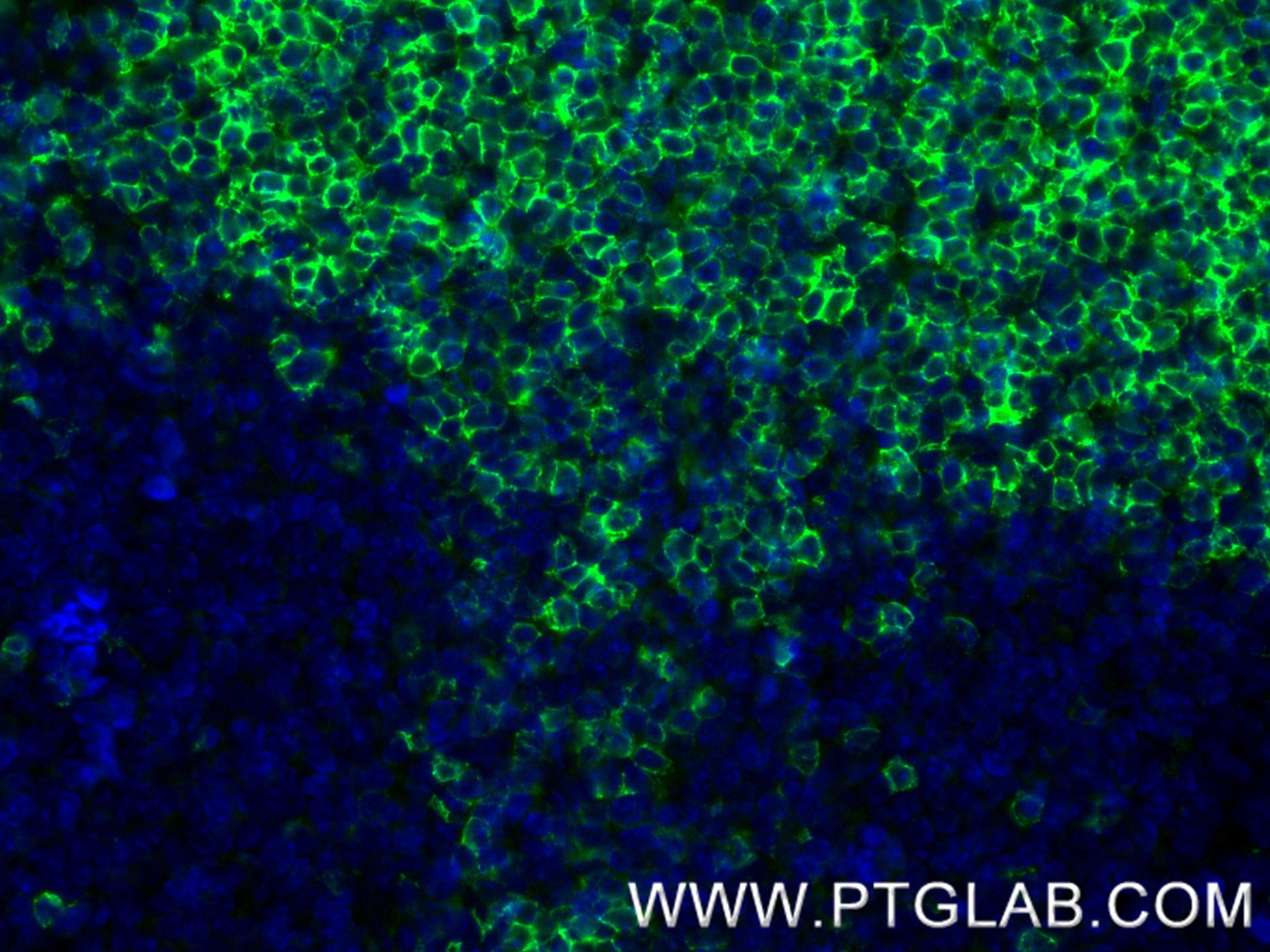 Immunofluorescence (IF) / fluorescent staining of mouse spleen tissue using CD23 Recombinant monoclonal antibody (84212-3-RR)